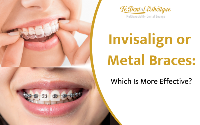Invisalign vs Braces: Expert Orthodontic Treatment by Dr. Charvee Devjee in Yerawada