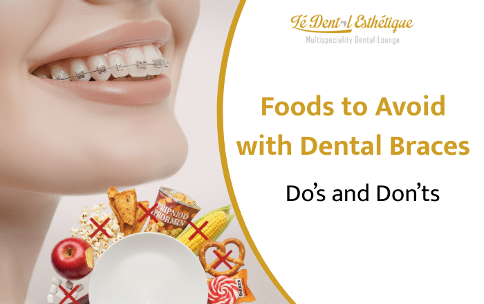 Foods to Avoid with Dental Braces: Your Complete Do’s and Don’ts Guide