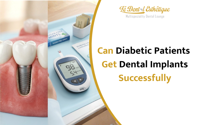 Can Diabetic Patients Get Dental Implants Successfully?