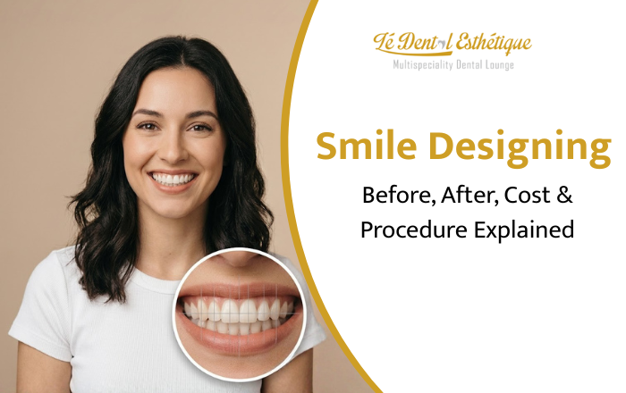 Smile Designing: Before, After, Cost & Procedure Explained