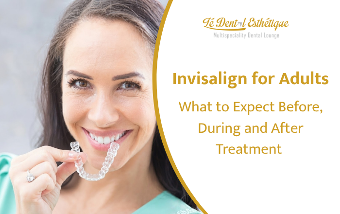 Invisalign for Adults: What to Expect Before, During and After Treatment