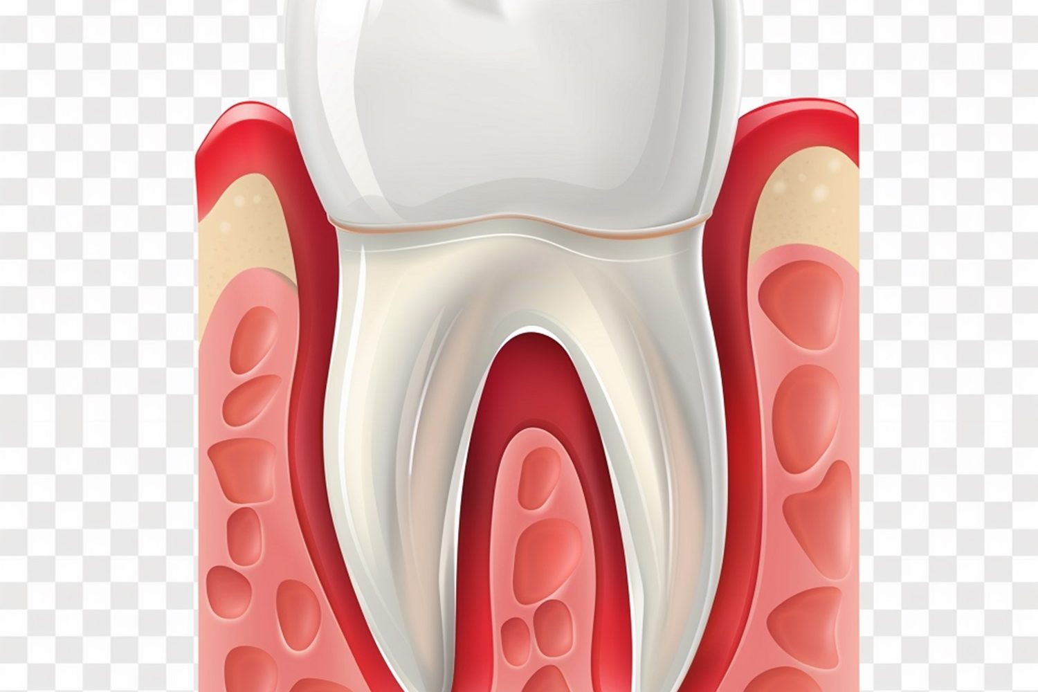 Unhealthy teeth character, oral care and hygiene, tooth restoration concept cartoon vector illustration